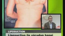Teoman Doğan : Liposuction Sonrası Korse Kullanımı