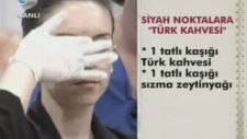 Yüzdeki Siyah Noktalara Doğal Bitkisel Çözüm