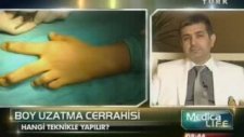 Boy Uzatma Ameliyatı