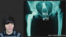 Funny X Rays