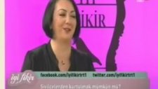 Sivilce Nasıl Geçer?