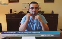 Dr. Ali Mezdeği - Yanak Germe Ameliyatı