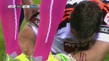 Kalecinin kafasını ezen futbolcu