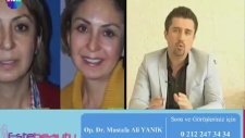 Op. Dr Mustafa Ali Yanık 35-40 Dk'da İplerle Yapılan Gençleştirme İşlemi Anlatıyor