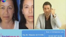 Op. Dr. Mustafa Ali Yanık Orta Yüz Germe İşlemi Anlatıyor