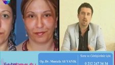 Op. Dr. Mustafa Ali Yanık Yüz Germe Estetiğini Anlatıyor