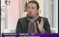 Yüzdeki Çiller Neden Olur ve Tedavisi Nedir