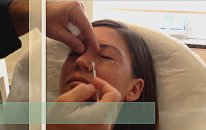 Antalya Botoks/Botox Merkezi