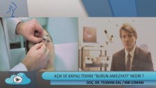 Açık ve Kapalı Teknik
