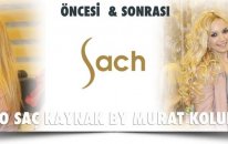 Mikro Saç Kaynak Uygulaması Murat Kolukırık
