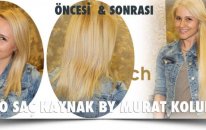 Mikro Kaynak Saç Uygulaması Yorumları