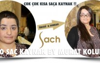 Yarım Santimlik Çok Kısa Saça Kaynak - Trikotillomani Saç Koparma Hastalığı