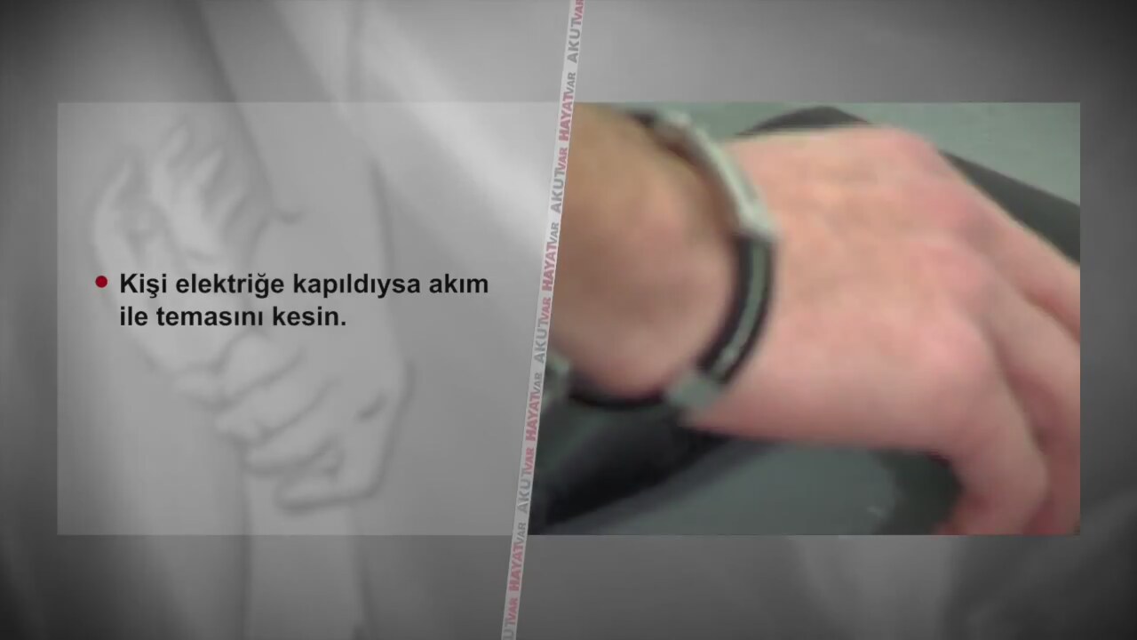 Yara bandı yanıklara karşı etkili midir Yanıklar türleri Yara bandı yanıklara karşı etkili midir Yanıklar türleri