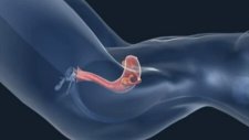 Aşılama Nedir ? Aşılama Nasıl Yapılır?