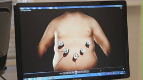 Gastrik Bypass Ameliyatı Nedir? (Prof.Dr. Oktay Banlı)