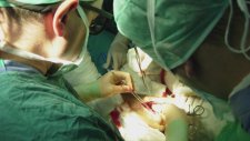 Lazer ile Varis Tedavisi Nasıl Yapılır? (Prof.Dr.Cüneyt Köksoy)