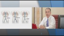 Toplardamar Tıkanıklığının Tedavisi Nasıl Yapılır? (prof.dr. Cüneyt Köksoy)