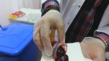 Van Hacamat Ve Sülük Tedavi Merkezi