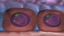 Genital Siğil (kondilom) Nedir? - Op.dr.korkut Arslan