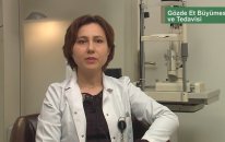 Gözde Et Yürümesi Kaşkaloğlu Göz Hastanesi