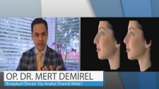 Op. Dr Mert Demirel Rinoplasti Öncesi Yüz Analizi Önemli Midir