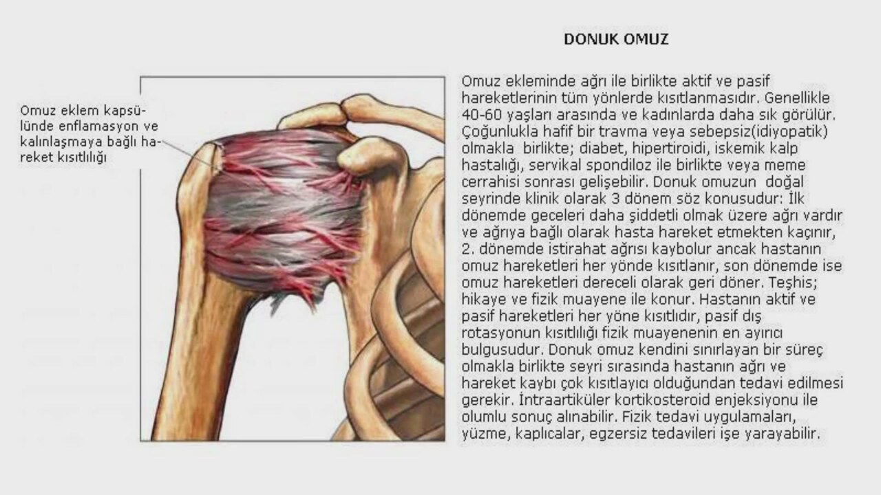 Omuz Ağrısı Nedenleri Omuz Ağrısı Nedenleri