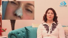 Revizyon Burun Estetiği Nedir?