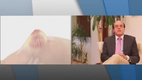 Meme Küçültme Ameliyatı Nedir? Hasta Hangi Şikayetle Gelir? - Op. Dr. İbrahim Oskui