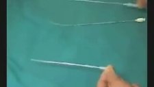 Tüp Bebek Transfer