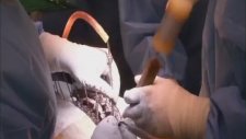 Omurga Ameliyatı - Medical Korea