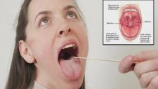Bademcik Nedir? - Op.Dr.Süreyya Şelendir