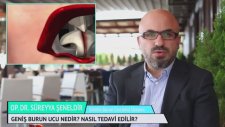 Geniş Burun Ucu Nedir? Nasıl Tedavi Edilir? - Op.Dr.Süreyya Şelendir