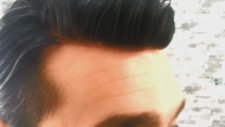 Hair Sistem - Doğal Protez Saç Uygulaması