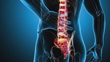 Bel Fıtığının Belirtileri Nelerdir? - Op. Dr. Mahmut Gökdağ