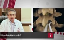 Mikrodiskektomi Nedir? - Op. Dr. Mahmut Gökdağ