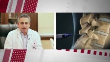 Şiddetli Bel Ağrısı Olan Hastalarda Uygulanan Kriyoplasti Nedir? - Op. Dr. Mahmut Gökdağ