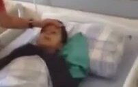 Sünnet Olan Çocuğa Narkoz Verilirse - Noldu Oldum mu?