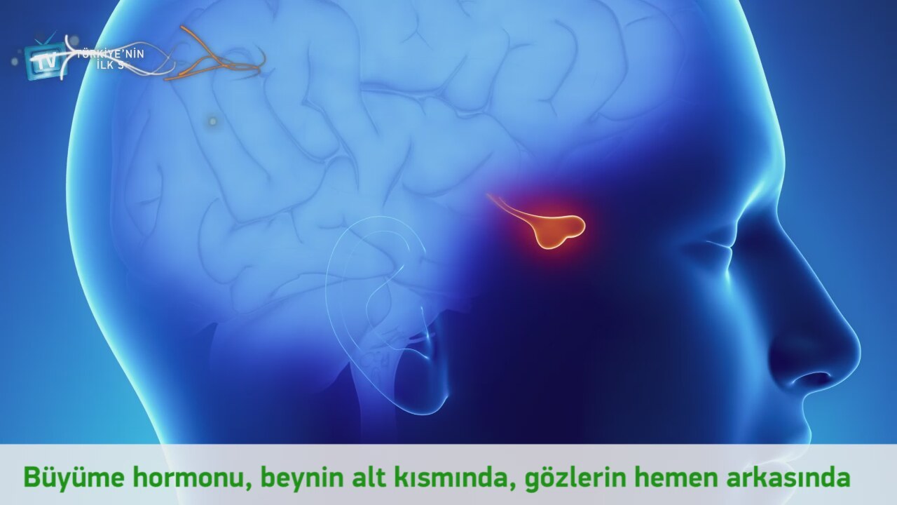 Akromegali nedir, belirtileri ve tedavisi Akromegali nedir, belirtileri ve tedavisi