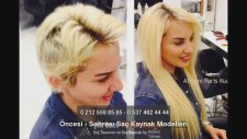 Öncesi - Sonrası Saç Kaynak Resimleri