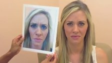 Öncesi ve Sonrasıyla Botoks (Botox Before After)