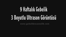 Hafta Hafta Gebelik 9. Hafta - Hamilelik Rehberi