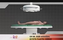 Hamilelik Sonrası Karın Germe - Liposuctin, Yağ Aldırma