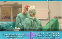 Liposuction Yağ Aldırma