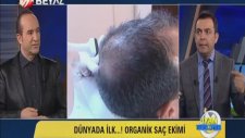 Organik Saç Ekimi Ne Kadar Sürer