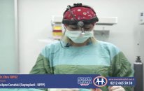 Kadrosunda Yer Alan Op.Dr. Ebru TOPUZ Uyku Apne Cerrahisi (Septoplasti - UPPP) konusunu anlattı