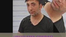 Prenses Peruk - Protez Saç Uygulaması - Saç Sorunları Merkezi - 0312 4193707