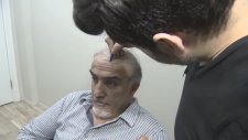 protez saç ve saç ünitesıyle ılgılı özel röportaj TGRT Tv . kayseri .