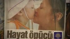 Kök Hücre Bağışı Nasıl Yapılır?