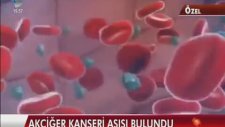 Küba'nın Akciğer Kanseri Aşısını Bulması