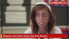 Dünyanın En Çirkin Kadını Hiç Kilo Almıyor